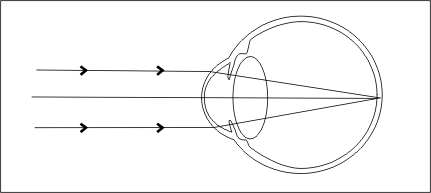 In the state of emmetropia, the eye structures converge light rays on the retina.